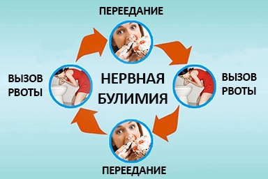 Лечение булимии в Северской